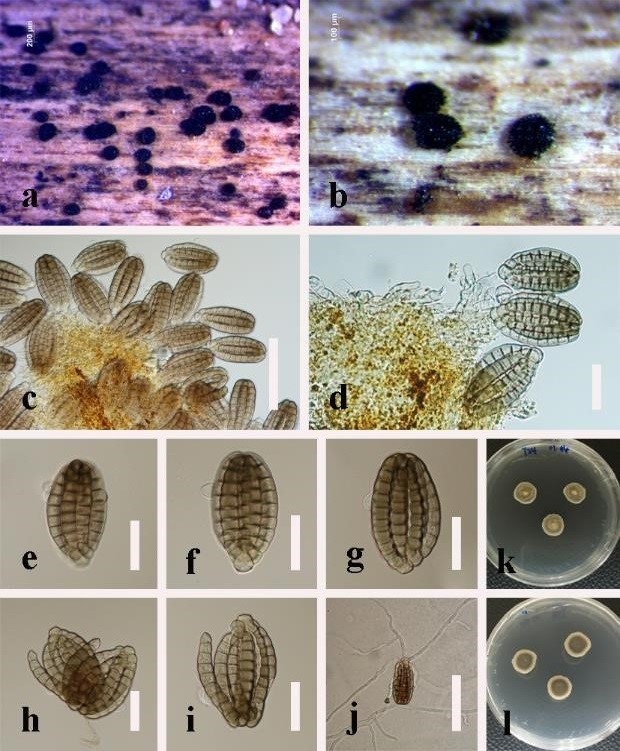 Hyphomycetes Figure 2