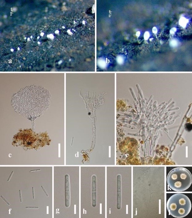 Hyphomycetes Figure 4