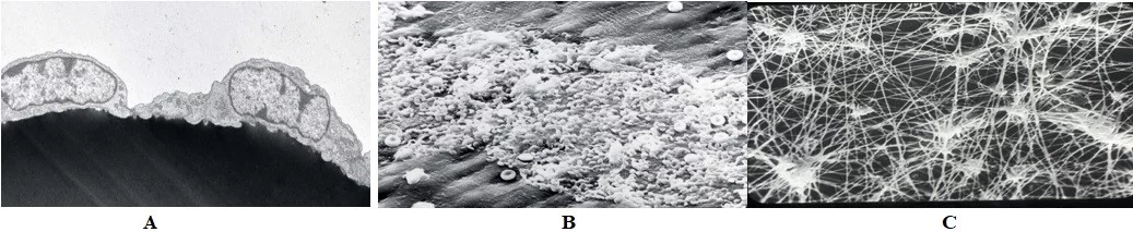 Electron micrographs