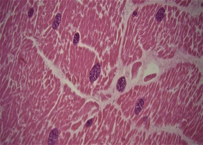 Figure 2: Severe cardiac sarcocystosis. The sections of sarcocysts are observed within cardiomyocytes (Hematoxylin and Eosin, × 10).